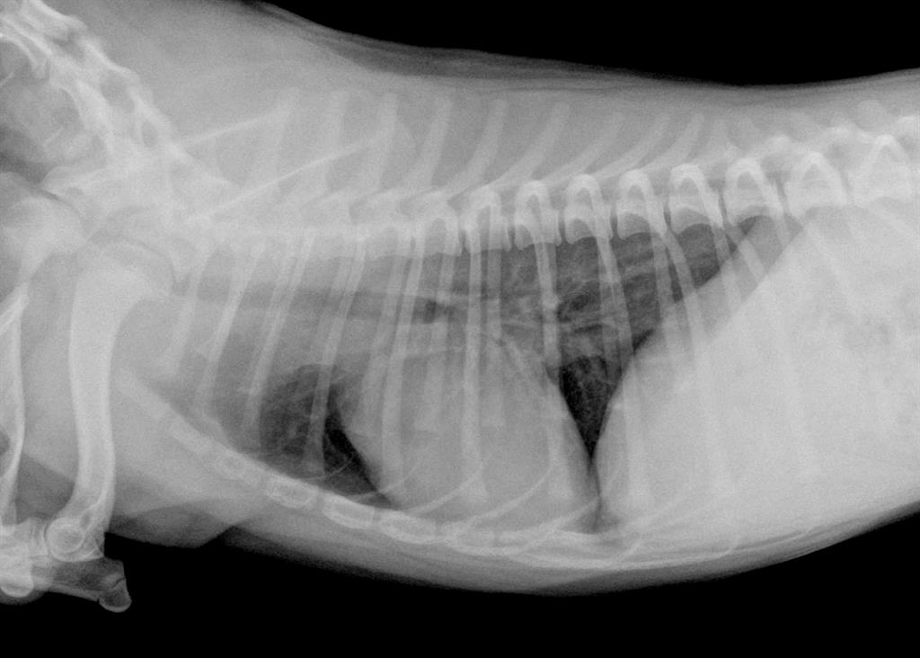 La radiographie thoracique est-elle utile dans les toux chroniques ?